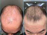 Hairformula1 для роста волос 100% гарантия - фото 2